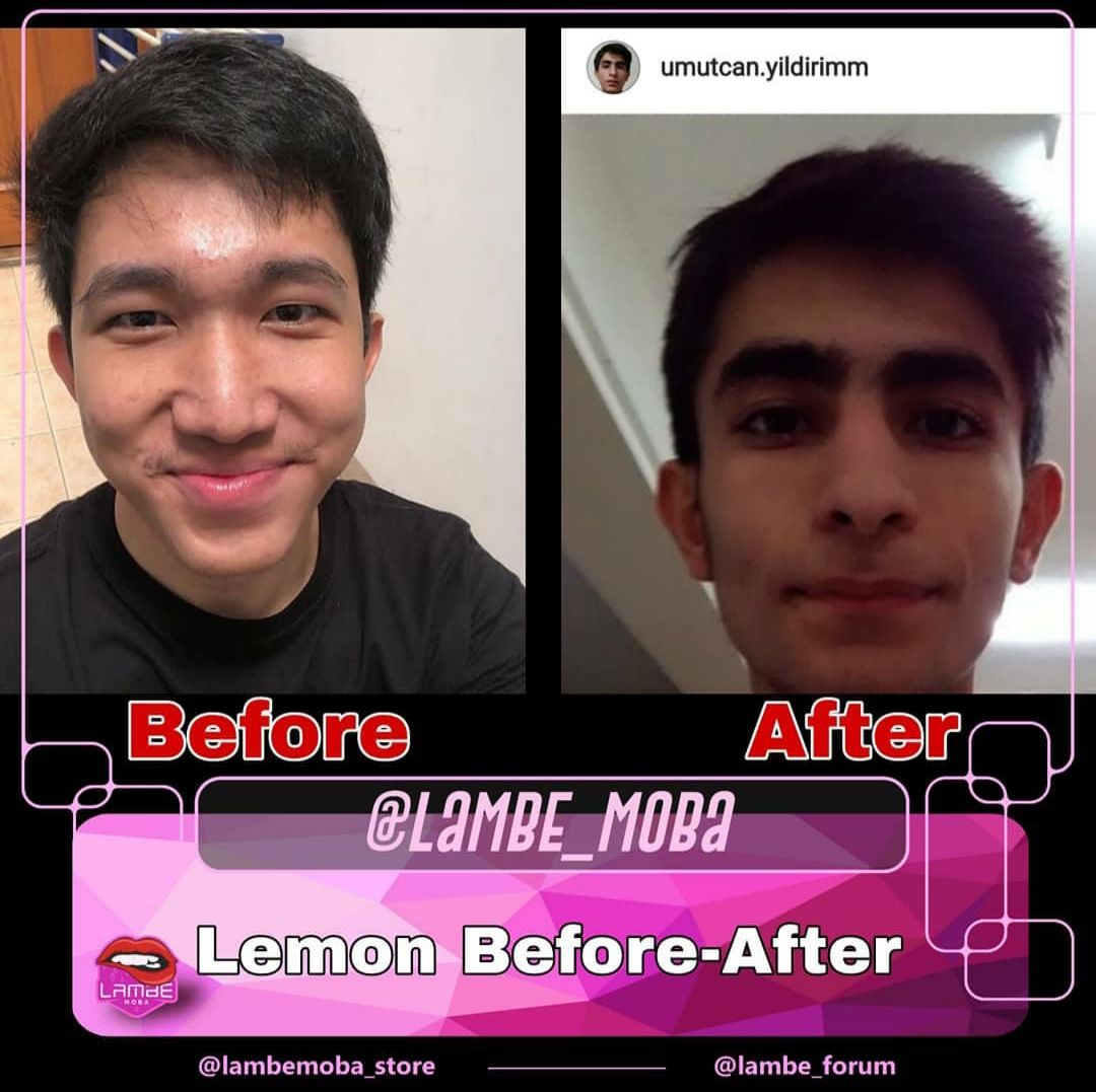 Instagram Lemon di hack, hacker posting foto selfie orang nggak dikenal