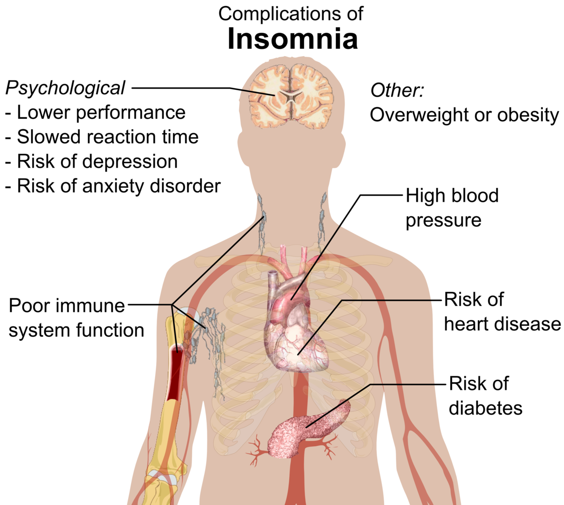 Dalam jangka panjang, pengurangan tidur juga berakibat pada obesitas, hipertensi, berbagai penyakit jantung, stroke, diabetes, disfungsi seksual, hingga peningkatan risiko kanker.