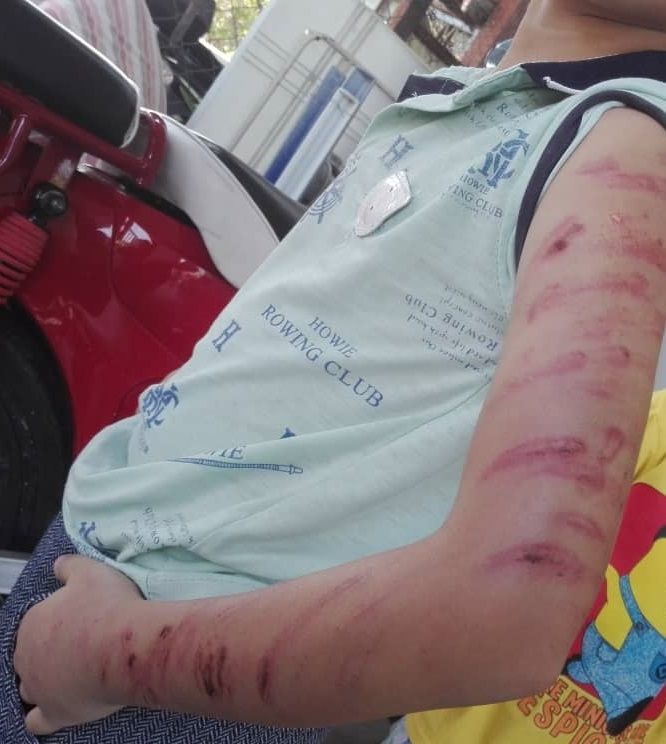 Sekujur tubuh bocah 6 tahun luka akibat dipukuli kakak tirirnya dengan rotan.