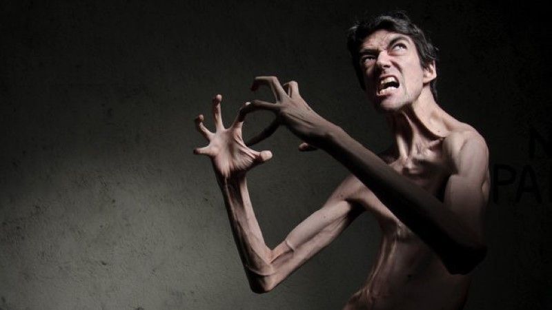 Javier Botet