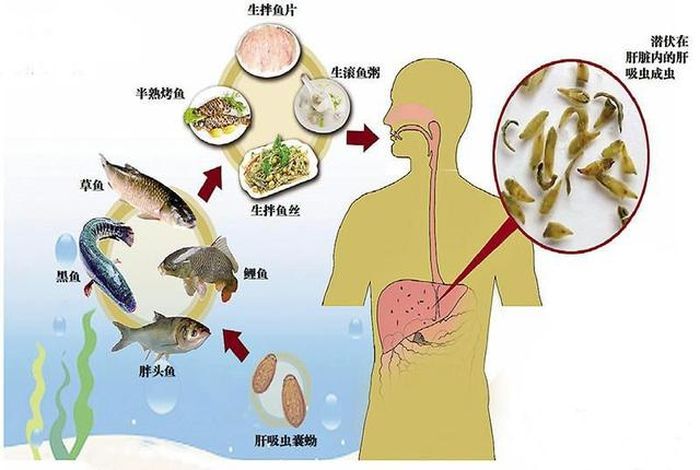 Ikan air tawar menjadi penyebab cacing parasit ini menyebar ke tubuh manusia.