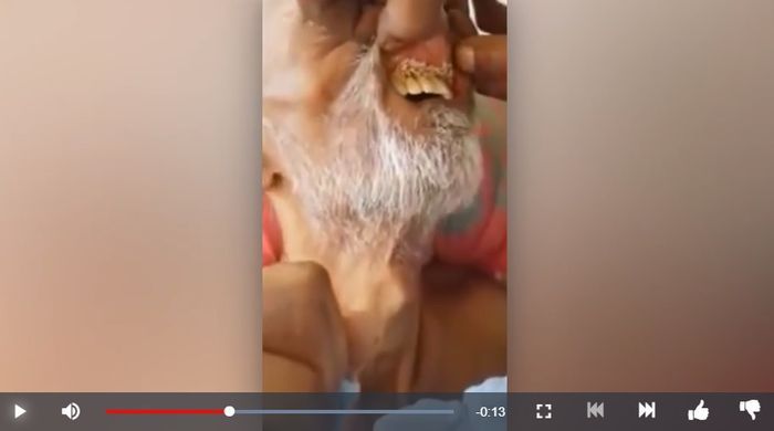 Belatung menggeliat di mulut pria lanjut usia