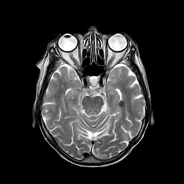 Ilustrasi scan otak