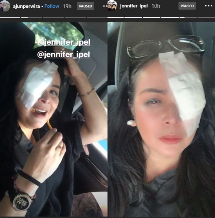 Mata kiri istri Ajun Perwira, Jennifer Jill, tampak diperban.