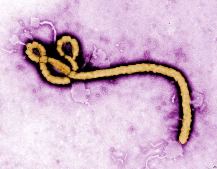 Ebola