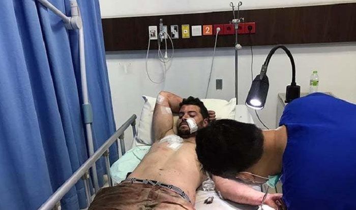 Bule Australia bernama Nicolas Carr, jadi pelaku penendangan pengendara Vespa di kawasan Sunset Road, Kuta (10/8/2019). 