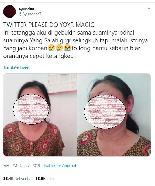 Kondisi sang istri setelah dihajar suaminya sendiri. 