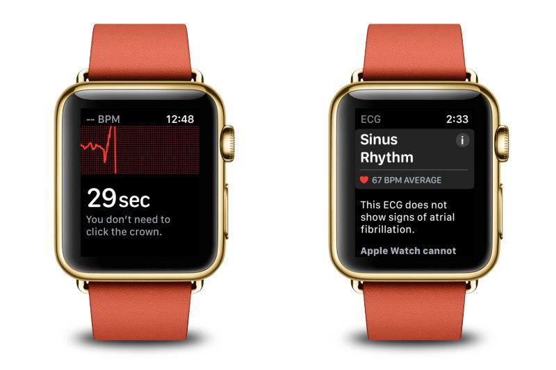 Penampilan fitur ECG di Apple Watch