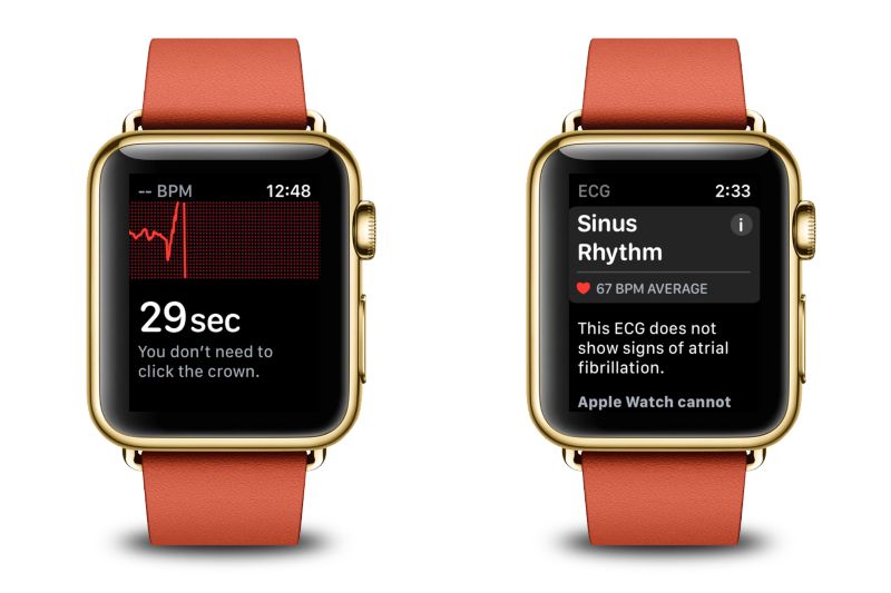 watchOS 6 Mampu Hadirkan Fitur ECG di Apple Watch 4 dan 5 India - Semua  Halaman - MakeMac