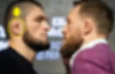 Kenapa Telinga Khabib Nurmagomedov Bentuknya Aneh? Ini Penyebabnya