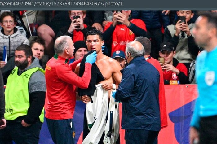 Cristiano Ronaldo mendapatkan peraawatan setelah hidungnya mengalami pendarahan dalam laga timnas Portugal vs Republik Ceska, Sabtu (24/9/2022) atau Minggu dini hari WIB.