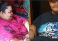 Berkaca dari Arya Permana dan Titi Wati, 3 Solusi Ini Perlu Dipertimbangkan Penderita Obesitas