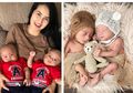Bayi Kembar Kadek Devi Memiliki Wajah Berbeda, Warganet Sebut Mirip Seseorang!
