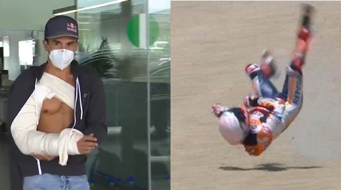 Panas! Mantan Rekan Valentino Rossi Bilang Marc Marquez Terlalu Percaya Perangkat Elektronik