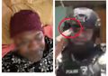 Polisi Asal Papua Ini Gagah Berjalan Meski Matanya Tertancap Panah, Begini Kondisinya Sekarang