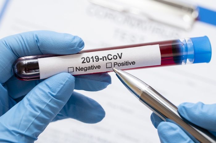 Ahli temukan vaksin penyembuh virus corona.