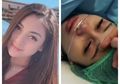 Celine Evangelista Bagikan Potret Operasi Caesar, Bukti Nyata Perjuangan Ibu Lahirkan Anaknya!