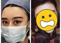 8 tahun Operasi Plastik, Perempuan Ini Punya Wajah Sama Persis dengan Artis Terkenal, Bisa Bedakan?