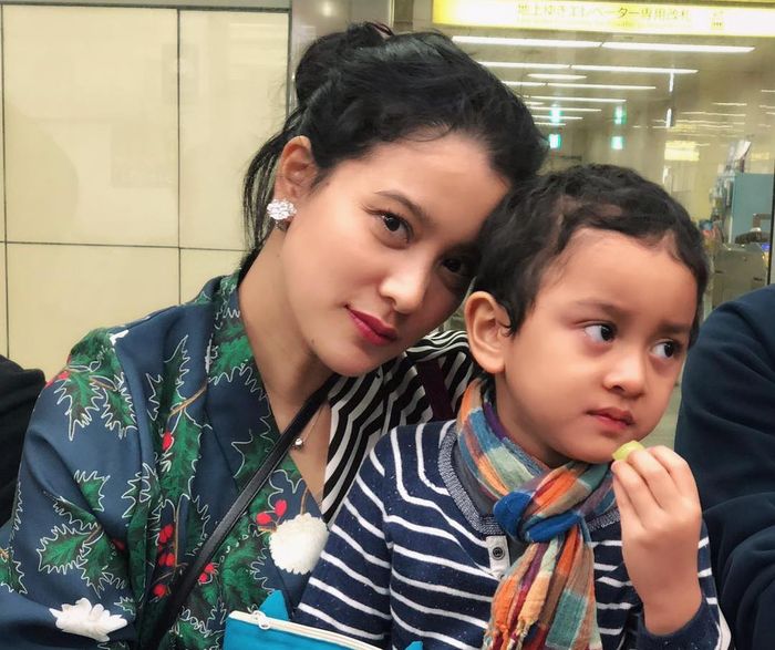Kondisi anak Marcella Zalianty masih mengkhawatirkan