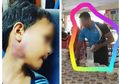 Sempat Menyangkal, Keluarga Buktikan Pemukulan Leher Murid Hingga Lebam Oleh Guru