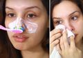 YouTuber Ini Coba Hilangkan Komedo dengan Sikat Gigi dan Odol, Berhasilkah?