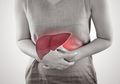 4 Tanda Awal Penyakit Liver Sering Diabaikan, Cek Sebelum Terlambat!