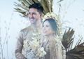 Menikah Bulan Depan, Tasya Kamila Setia Temani Mama Sambil Bikin 'Pabrik Undangan' di Rumah Sakit