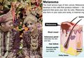Tidak Ribet, Ini Cara Sederhana untuk Mencegah Kanker Melanoma yang Menyerang Adara Taista