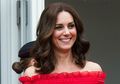 Selalu Tampil Sempurna, Kate Middleton Ternyata Memiliki Bekas Luka Besar di Kepalanya