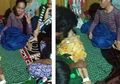 Seorang Anak Meninggal Dunia Diduga Setelah Pencet Bisul di Hidung, Ternyata Ada Area Berbahaya di Wajah!
