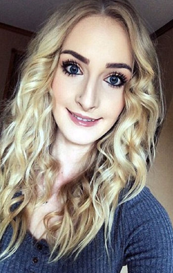 Wajah Lauren Whitt Setelah Operasi dailymail.co.uk