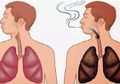 Cara Detoks Paru-paru, Kembali Bersih dan Sehat dalam 72 Jam!
