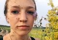 Bikin Aksi 'Jangan Lupa Beri Makan Nyamuk', Wanita Siberia Ini pun Mengguncang Instagram