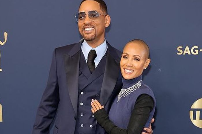 Jada Pinkett Smith diejek Chris Rock karena penampilannya, ternyata alami Alopecia. Apa itu?