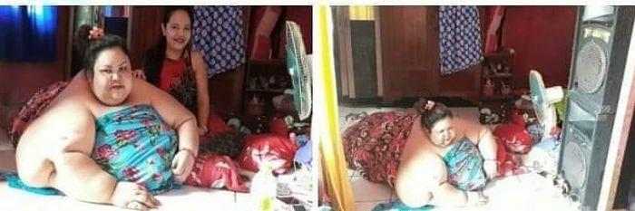 Titi Wati wanita berberat badan 350 Kg.