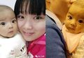Demi Selamatkan Bayinya, Ibu Ini Rela Donorkan Hati Tanpa Sepengetahuan Orangtua