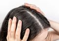 Tips Jitu Menghilangkan Ketombe yang Bikin Rambut Gatal, Cukup Gunakan Bahan-bahan Alami Ini