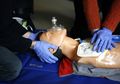 Pertolongan CPR Bisa Selamatkan Nyawa, Siapa yang Boleh Melakukannya?