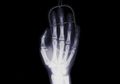 Berguna di Dunia Medis, Cari Tahu Fakta Seputar Sinar X-Ray, yuk!