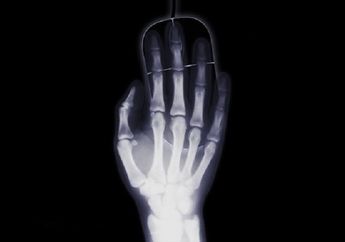 Berguna di Dunia Medis, Cari Tahu Fakta Seputar Sinar X-Ray, yuk!