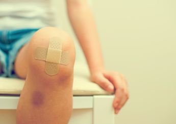 Tiba-Tiba Muncul Luka Memar di Kaki? Cari Tahu Penyebabnya, yuk!