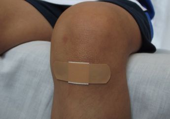 Selain Menyehatkan, Madu Juga Bisa Digunakan untuk Menyembuhkan Luka