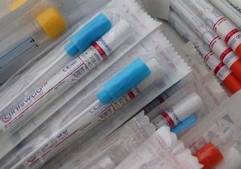 Rapid Test dan Tes Swab Berguna untuk Mendeteksi Infeksi Corona, Mana yang Hasilnya Lebih Akurat?