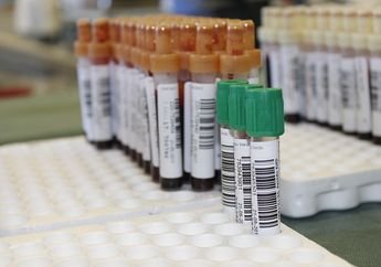 Bisa Percepat Penyembuhan COVID-19, Ini Manfaat Terapi Plasma Konvalesen