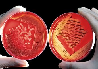 Jawab Soal Biologi kelas 10, Tingkatan Objek yang Dipelajari dalam Biologi