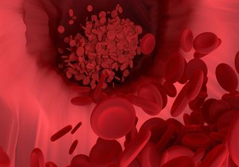 Apa Itu Penyakit Anemia? Ketahui 4 Jenis Anemia yang Sering Terjadi pada Manusia
