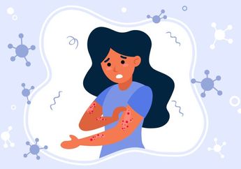Apa Itu Cacar Monyet? Berikut Penjelasannya