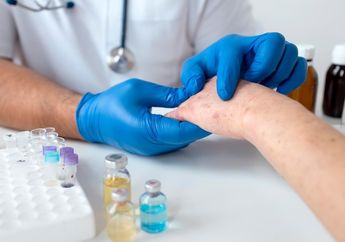 6 Cara Mengantisipasi Penularan Cacar Monyet, Salah Satunya Terapkan PHBS