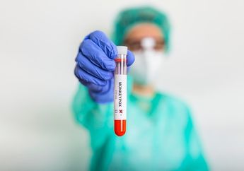 Vaksin Cacar Monyet Belum Tersedia di Indonesia, Berikut Obat untuk Membantu Kondisi Pasien Cacar Monyet