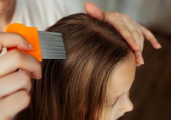 Barapa Lama Kutu Rambut Bisa Hidup di Kepala Manusia?
